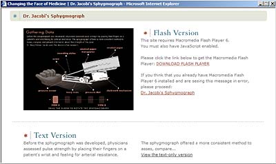 A text description of how the Sphygmograph works
